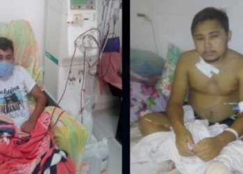 Jovem de 25 anos precisa de ajuda financeira  para realizar transplante em Fortaleza (CE)